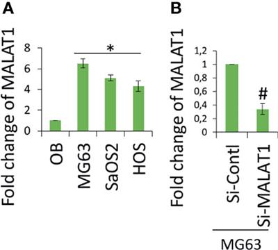 LncRNA MALAT1 Promotes Tumor Angiogenesis by Regulating MicroRNA-150-5p/VEGFA Signaling in Osteosarcoma: In-Vitro and In-Vivo Analyses